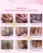 MeiYanQiong-Herbal-Nail-Fungus-Treatment-Onychomycosis-Paronychia-Anti-Fungal-Nail-Infection-Chinese-Herbs-Toe-Nail-Repair