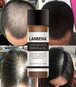 Lanbena Hair Growth Essential Oil