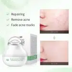 Fenyi pro herb repairing anti-acne cream