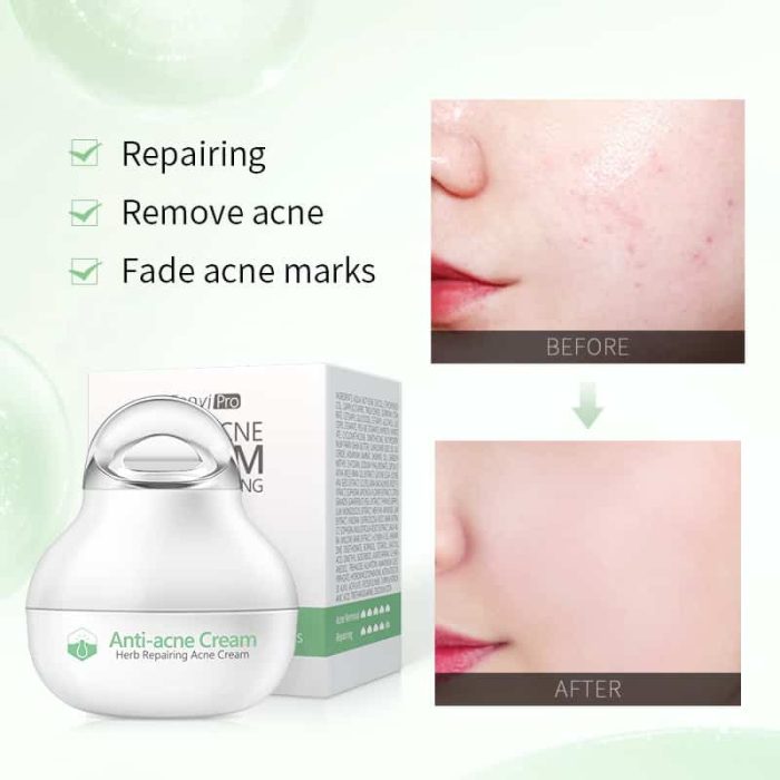 Fenyi Pro Herb Repairing Anti-Acne Cream