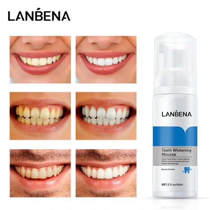 Lanbena Teeth Whitening Mousse