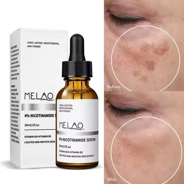 Melao Nicotinamide Serum - Niacinamide 4% Vb3+Vb5 -30Ml